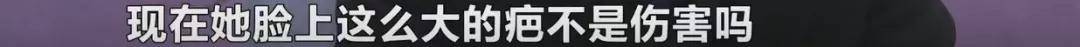 维权长沙一女子花5000元祛斑后懊恼被“毁容”,工作人员:正常现象