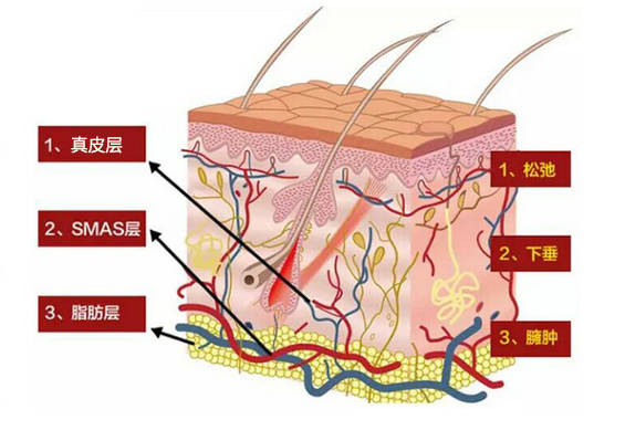 皮肤什么是赫本线？联合丽格向淑英抗衰新理念：45°赫本线紧致术