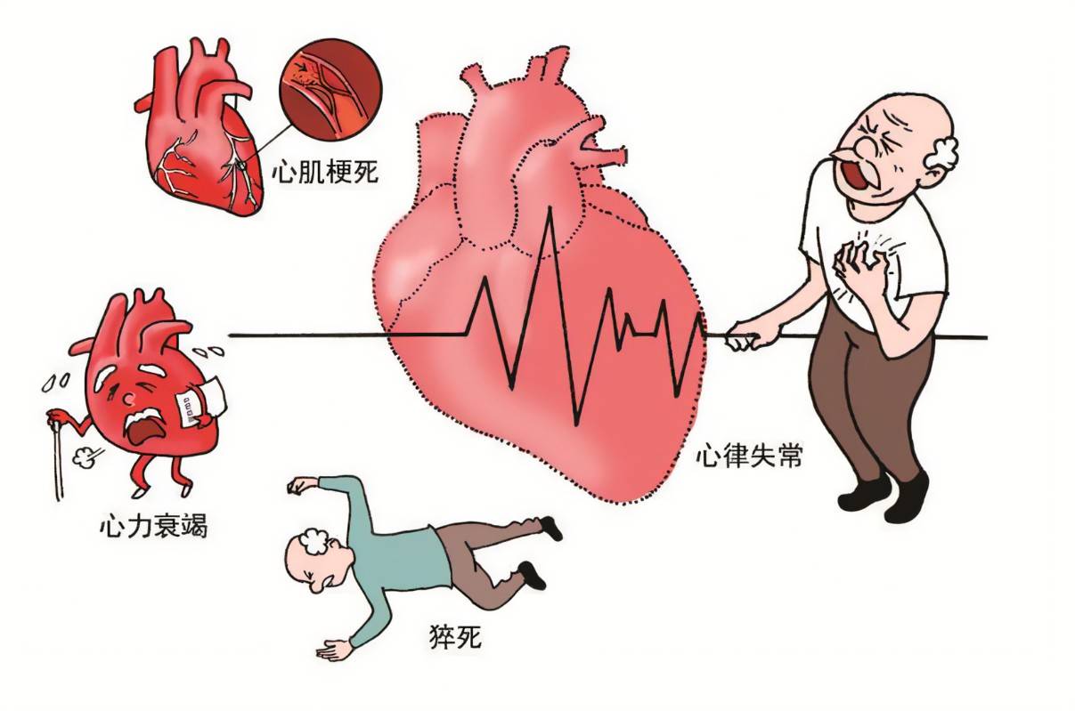 猝死卡通图片