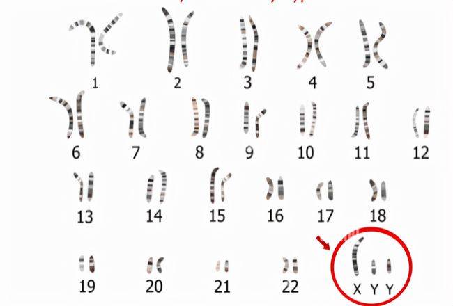 正常的染色体报告图解图片