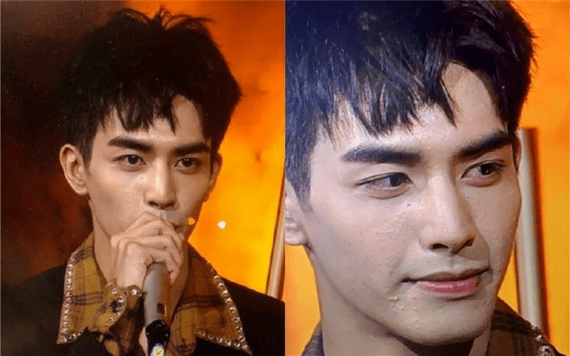 高清生浮粉、长痘、整容痕迹，明星未修图里的脸，让我看见了人间真实