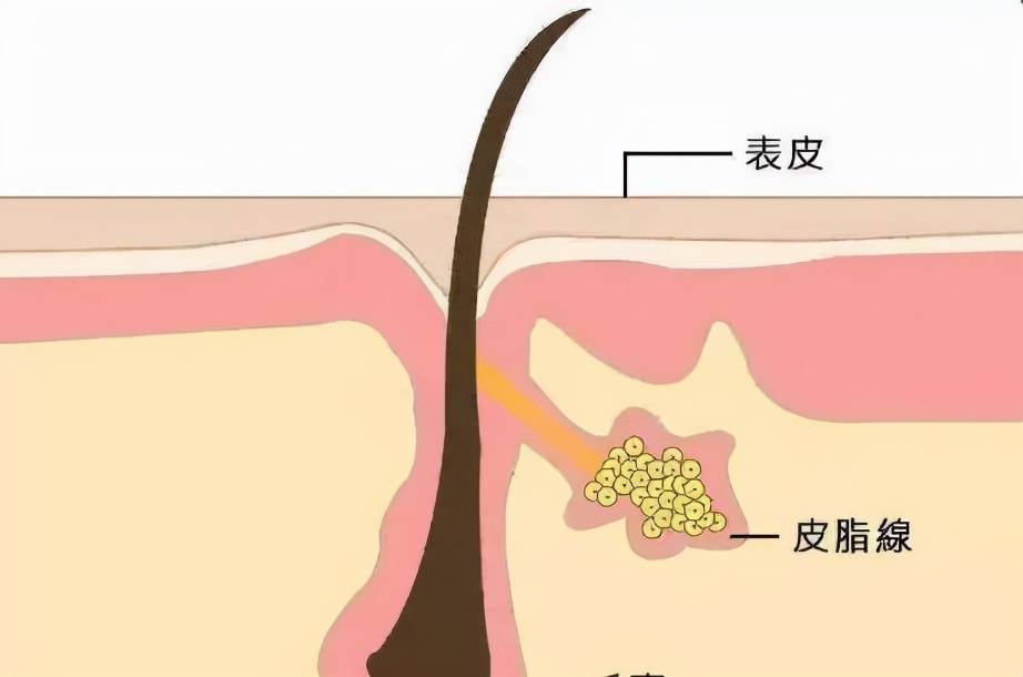 毛周她鼻背两旁的小疙瘩，到底是啥？