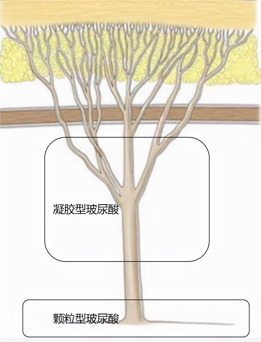 大肠人生无常，大肠包小肠，腿精变肿精？