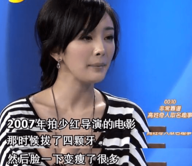 脸部明星整牙后遗症:杨幂脸部松弛,王嘉尔颧骨外扩,宋祖儿法令纹深