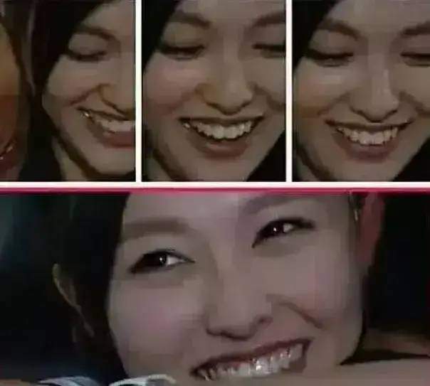 脸部明星整牙后遗症：杨幂脸部松弛，王嘉尔颧骨外扩，宋祖儿法令纹深