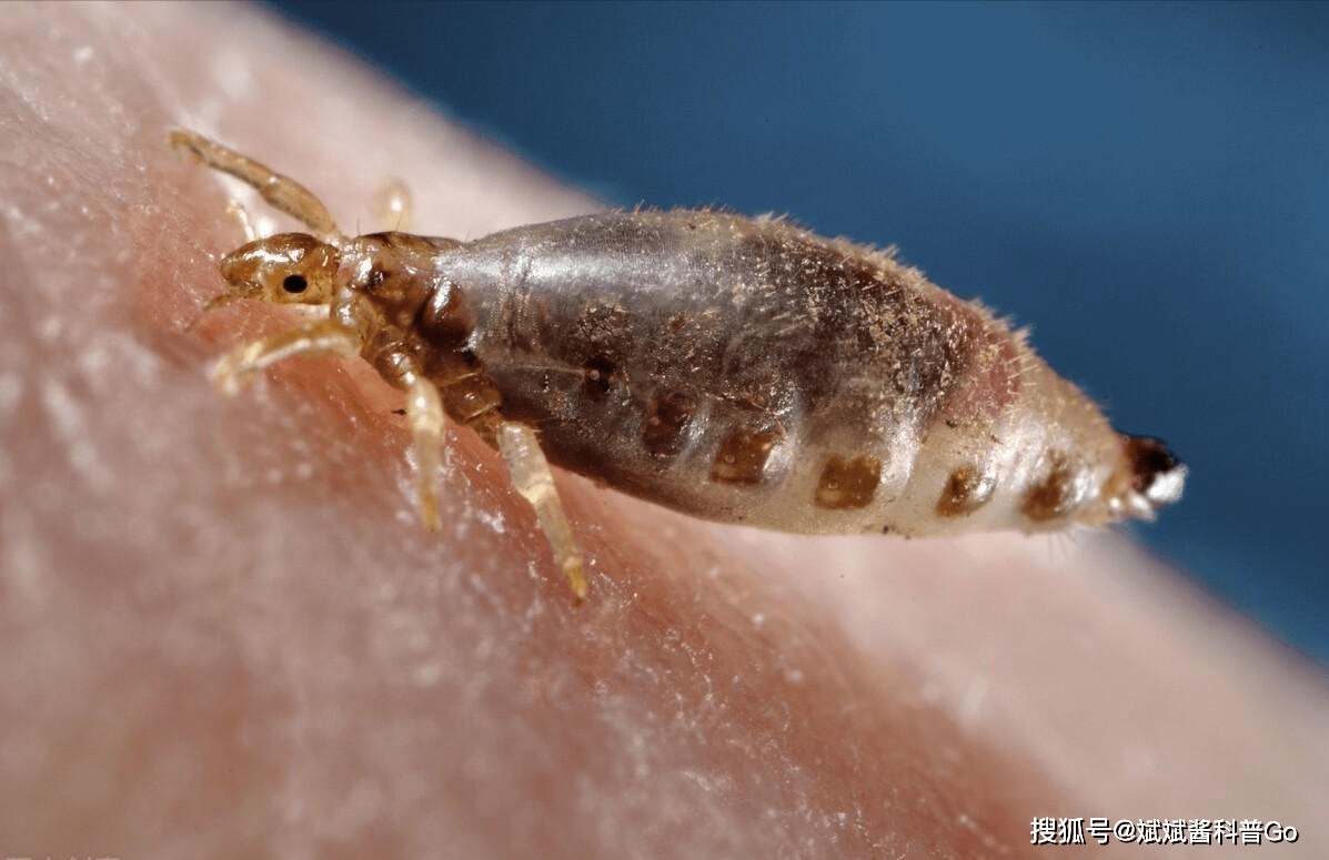 忆往昔，虱子没少折磨人，它缘何而来？看今朝，虱子又为何消失？_搜狐网, image size:1197x775