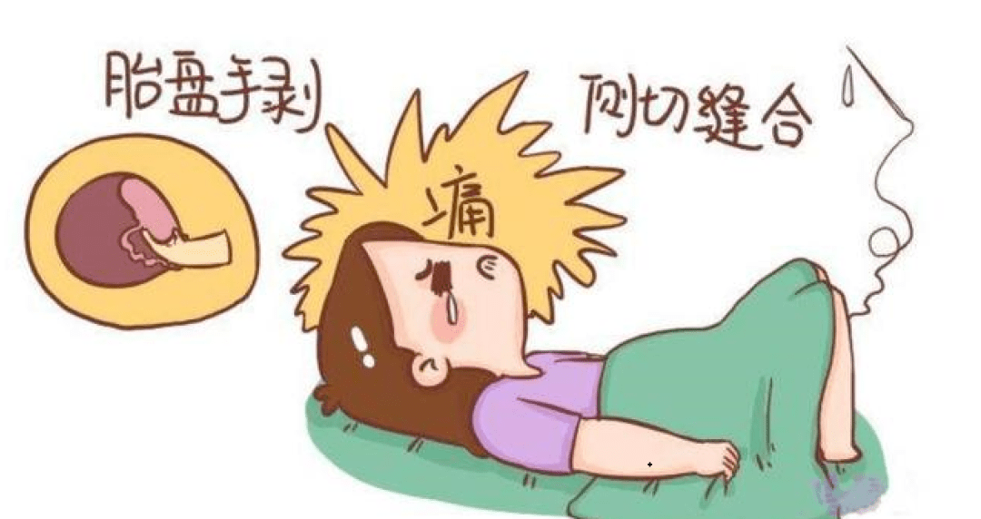 生孩子究竟有多痛麻醉医生带你正确认识无痛分娩