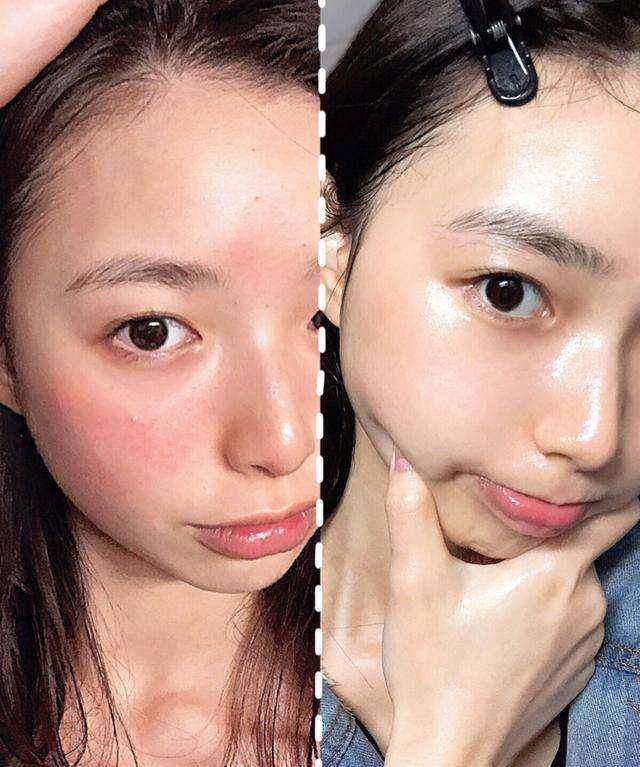 毛孔张嘉倪对自己“真狠”，把黑油皮变成“奶白肌”32岁看着像18少女