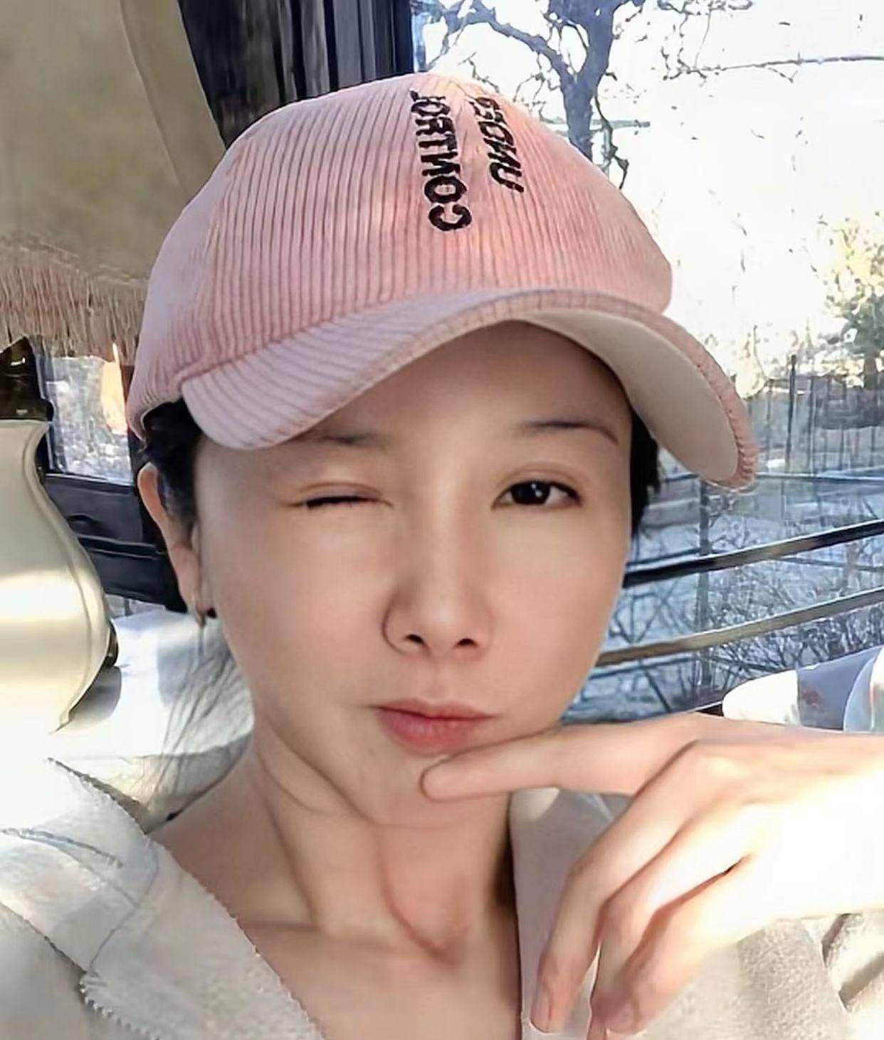 后遗症女明星为了变美，乱整鼻子留下的后遗症，至今悔恨终身