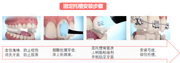 文章配图-10
