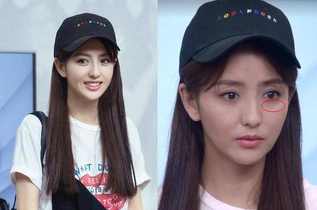 戚薇36岁佟丽娅老成这样?黑眼袋严重吓坏众人,粉丝:丫丫擦下眼霜吧