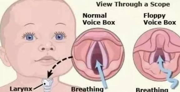 怎么让自己有痰 4a38b5b069d64825b2c4ea5fc575b03b.jpeg