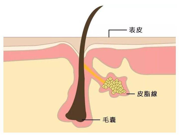 长痘痘怎么别的地方就不长痘？