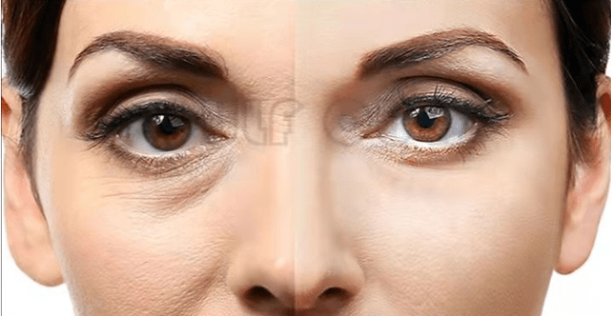 严重真相:7d聚拉提会加速衰老吗、7d聚拉提一次效果维持多久?