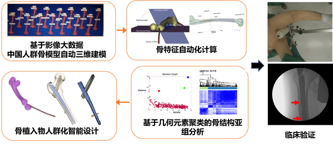 形态|南京航空航天大学团队开展骨植入物人群化智能设计！