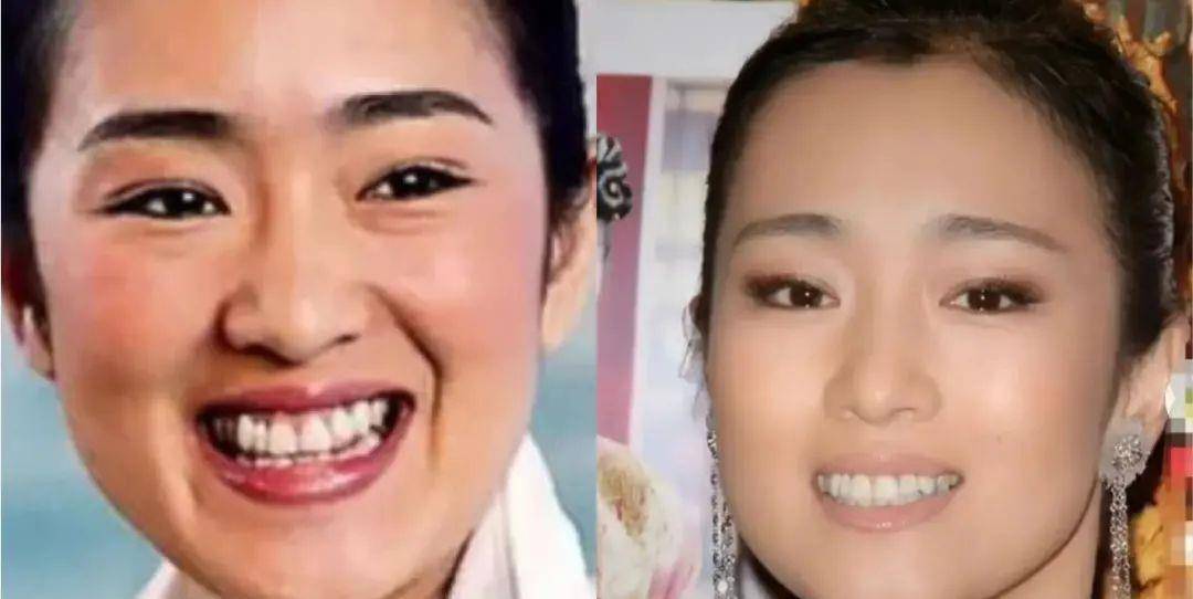 小天关晓彤是不是do脸了？凹脸变得幼态又平整