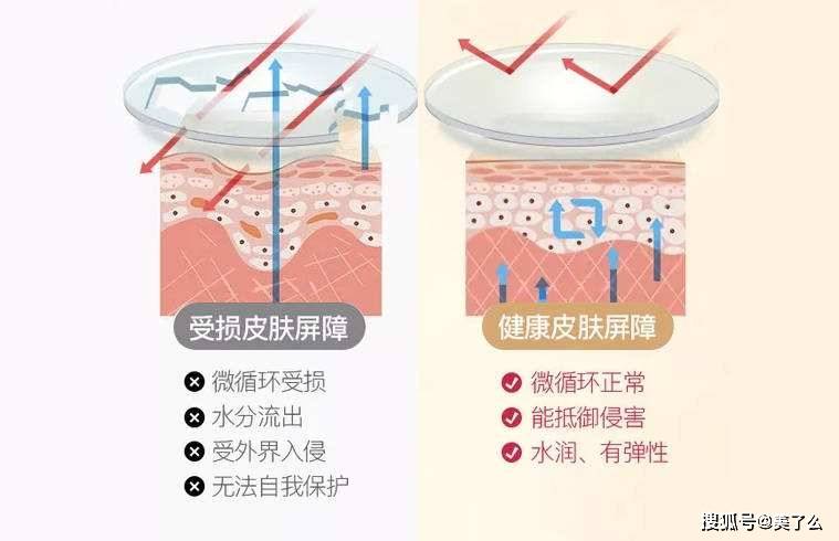 止损皮肤屏障受损是那些原因导致的