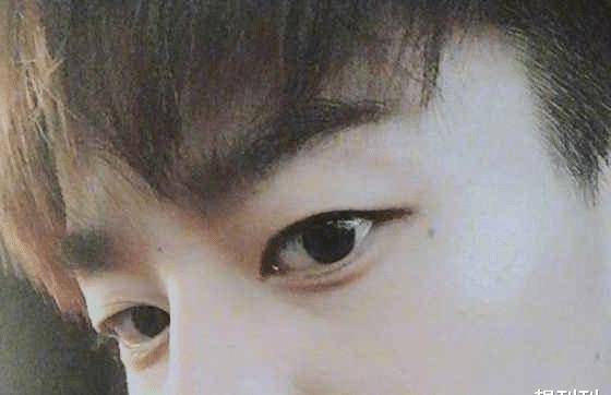 单眼皮内娱最假双眼皮PK，就差割到脑门了，生怕别人看不出是割的？