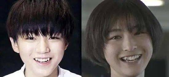 牙龈关晓彤是不是do脸了？凹脸变得幼态又平整！