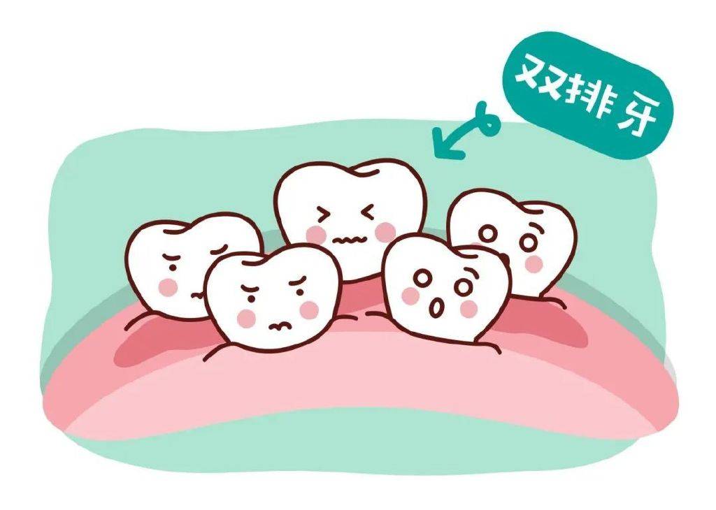 一不留神孩子长出双排牙拔还是不拔济南九二零口腔医院科普