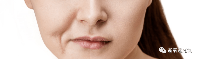 技术从雪碧代言看吸脂的前世今生