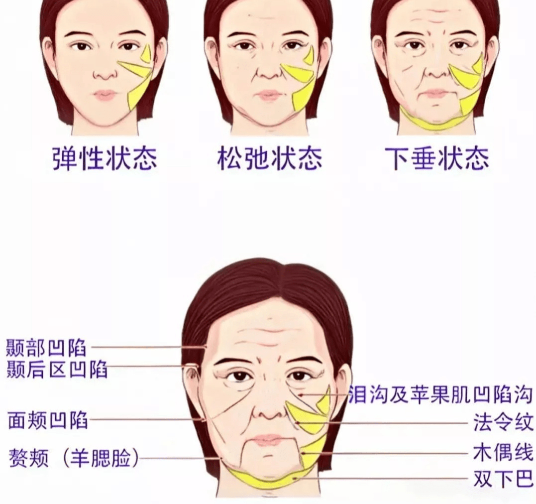 什么苹果肌下垂的原因是什么？