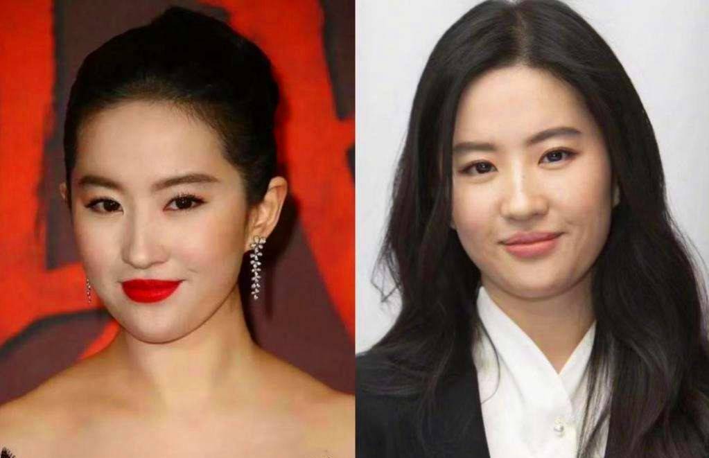 因为发腮比发胖更可怕，颜值降低是小事，有人干脆被换了张脸