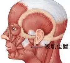 玛吉20岁发腮了怎么办?