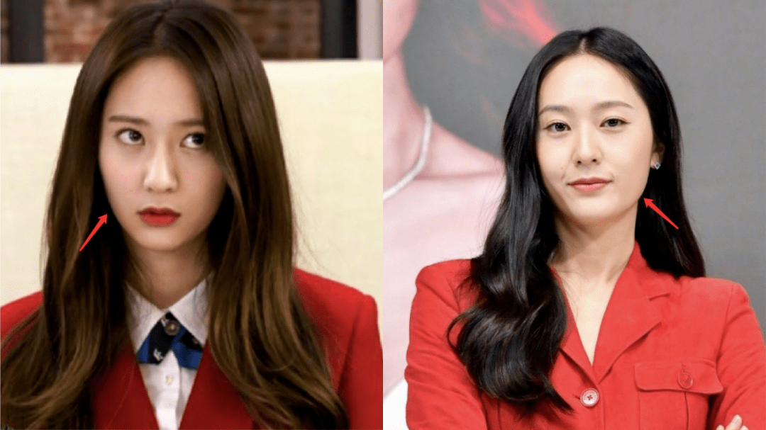 玛吉20岁发腮了怎么办?