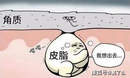 大小如何分辨是脂肪粒还是粉刺？