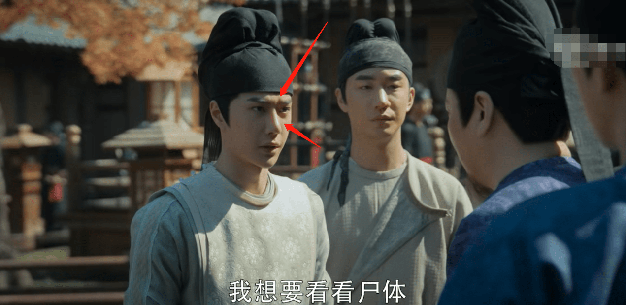 陈晓东脸部肿胀、五官扭曲，这些痴迷医美的男明星，不怕后遗症吗？？