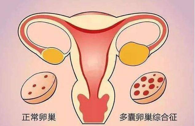腋毛为什么有的女性体毛旺盛，有的却“光秃秃”？看完涨知识了