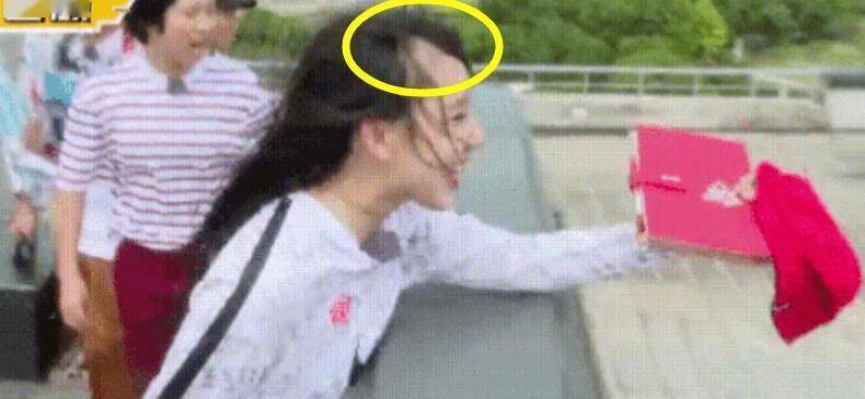 假发沈梦辰的头顶秃了，发亮的多与少真的是现代人的焦虑啊