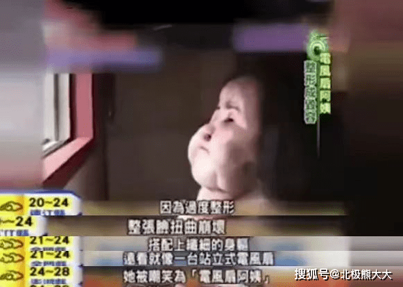 因为痴迷整容15年，把脸整成“电风扇”后遗症明显，韩慧景后悔了吗？