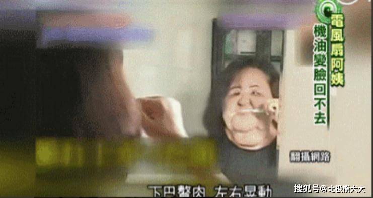 因为痴迷整容15年，把脸整成“电风扇”后遗症明显，韩慧景后悔了吗？