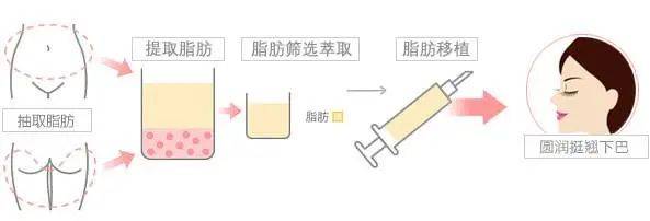 下巴整形医生揭秘：为什么明星都爱do下巴？看完你就明白了！