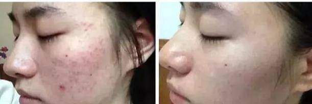 黑头同为姐妹43岁大S颜值回春，只要做到这一点，你也可以实现“冻龄“