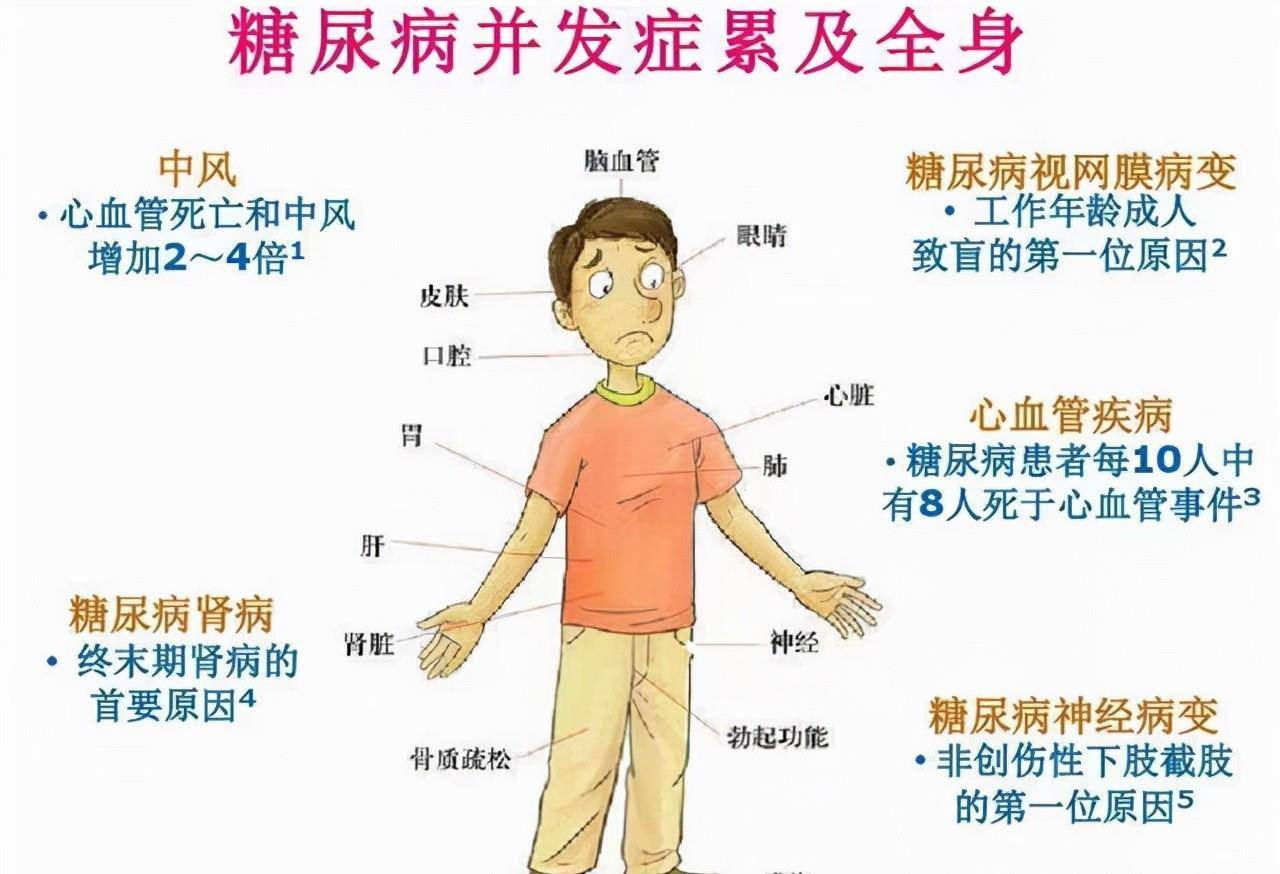 烤红薯|58岁陈叔因血糖过高死亡，医生提醒：2种素食，糖尿病人尽量少吃