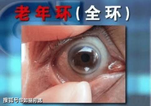 眼睛叫我阿姨？！为什么现在二三十岁的年轻人，外貌上的年龄特征没那么明显了？
