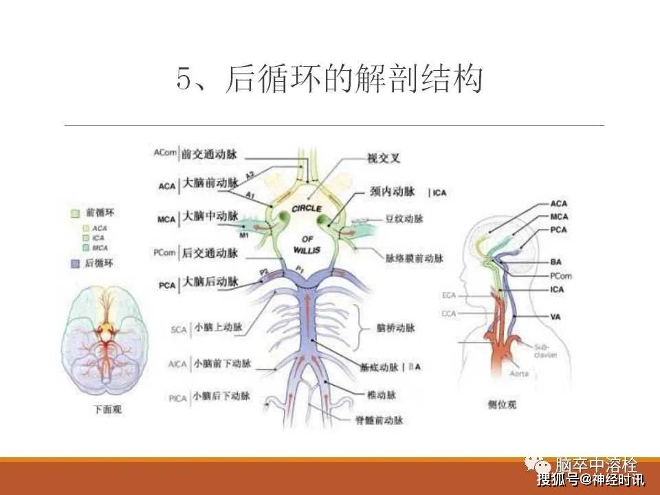 一篇讲透后循环缺血性卒中