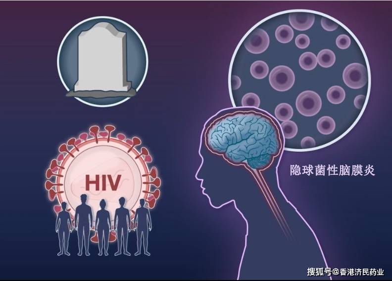 单剂量安必素联合治疗隐球菌性脑膜炎不劣于世界卫生组织推荐疗法