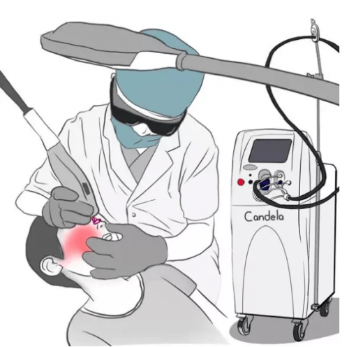 西安国际医学美容中心徐薇主任 激光术前适应症及术后注意事项_治疗