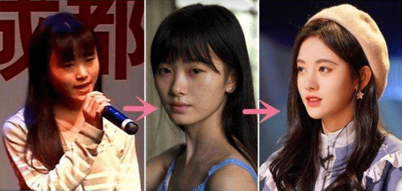 下巴整前似大妈、整完变少女？这些“回炉重造”的女明星，太成功了！