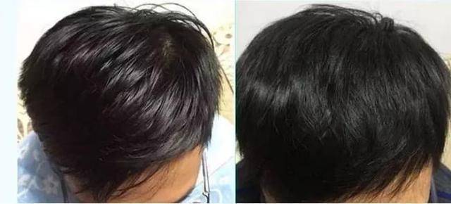 因为建议女生：头发扁塌出油快，外出前加上这一步头发清爽蓬松显气质