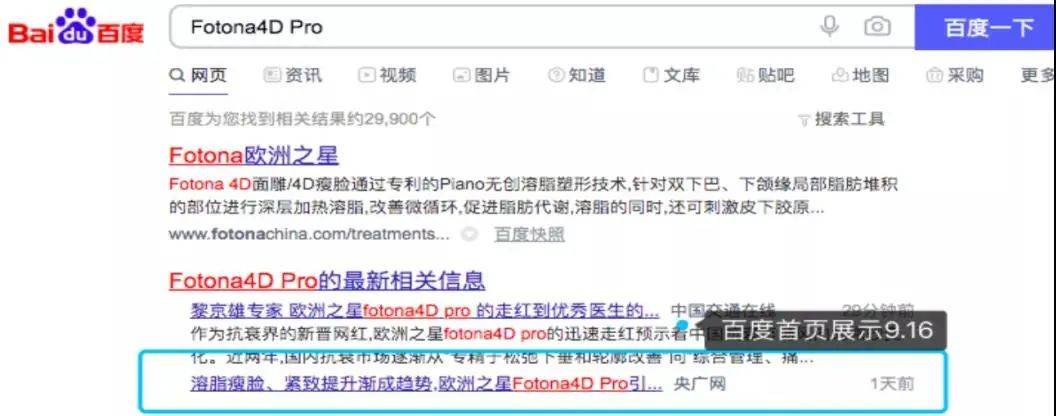 治疗欧洲之星FOTONA到底是什么？