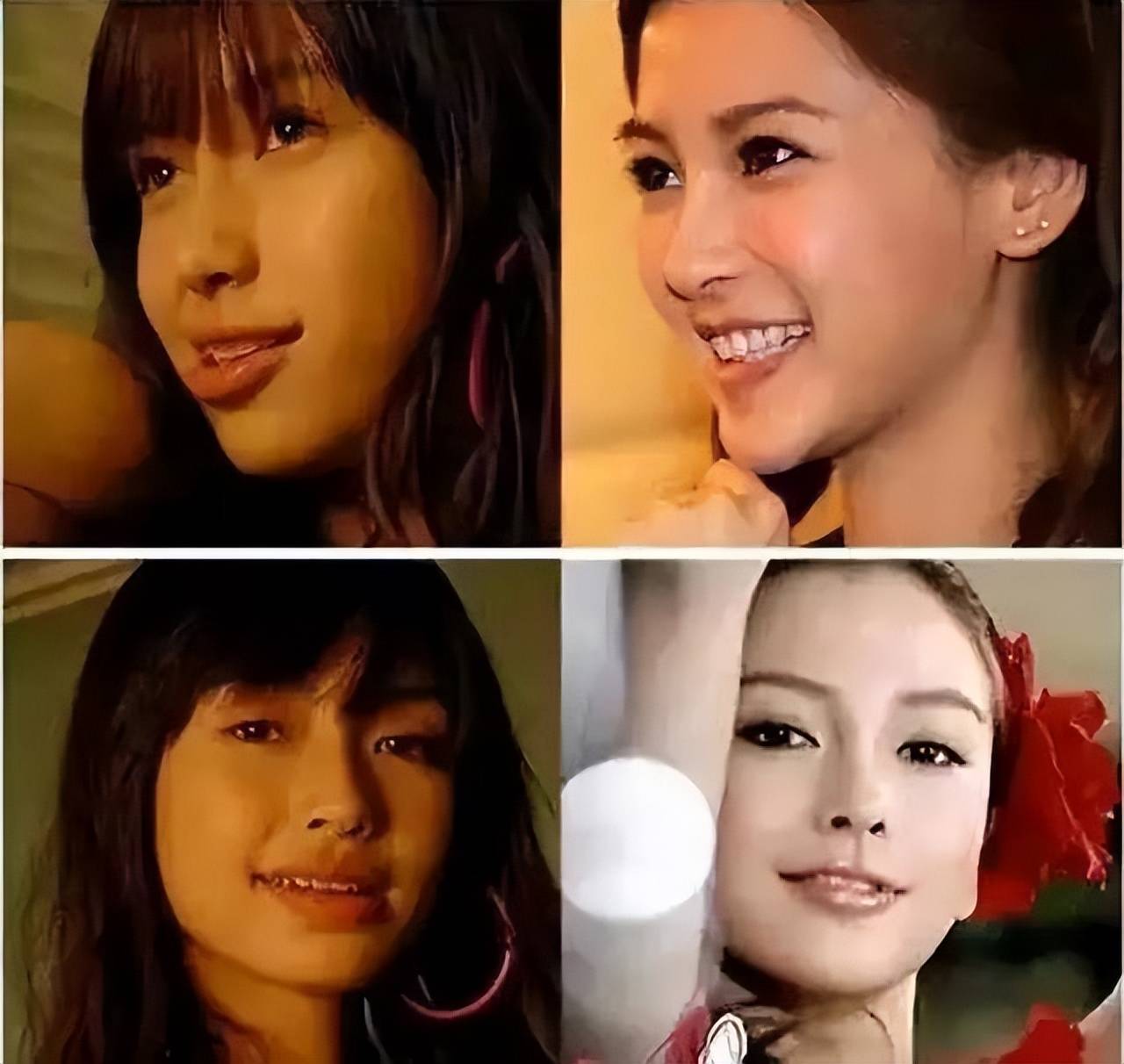 张嘉倪_因为_牙齿