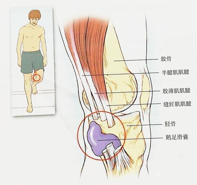 成都膝关节专科医院:膝盖内侧隐隐作痛是怎么回事?