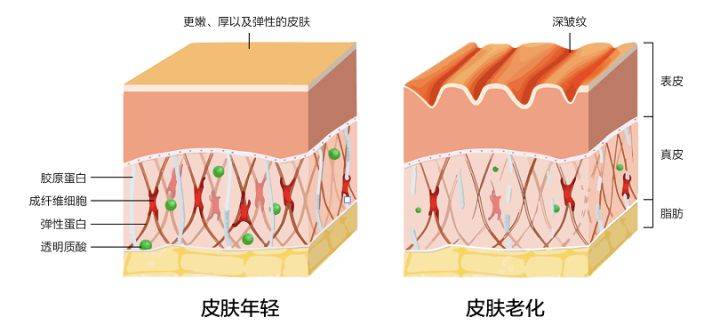 三十岁了， 皮肤慢慢衰老怎么办？如何挑选抗衰老护肤品？