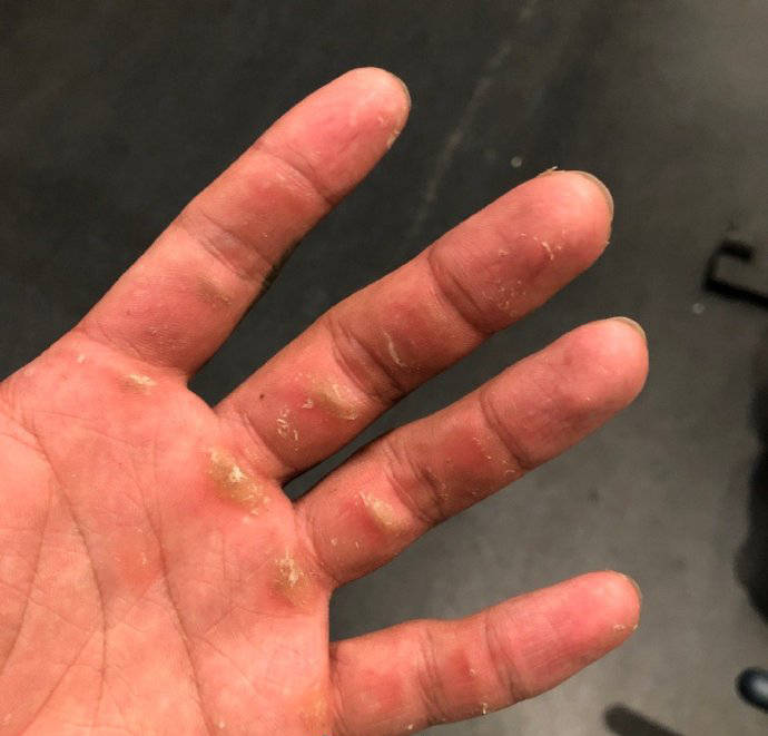 原创牛蛙腿麒麟臂健身撸铁打造满身肌肉手上的老茧就是勋章