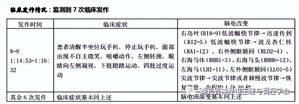 右額極,右前中顳底)sz2(4)(右額極,右前中顳底)sz1 右顳底(avg)pet ct